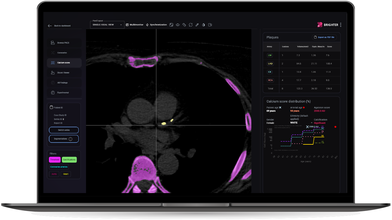 Bright Point Radiologic BRIGHTER Medical Imaging Platform - brighter-imaging.com